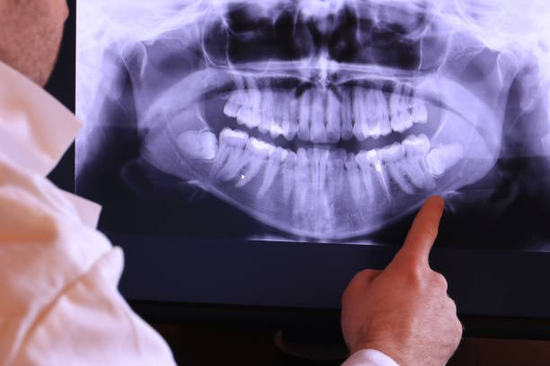 Urgent Tooth Repair in AK